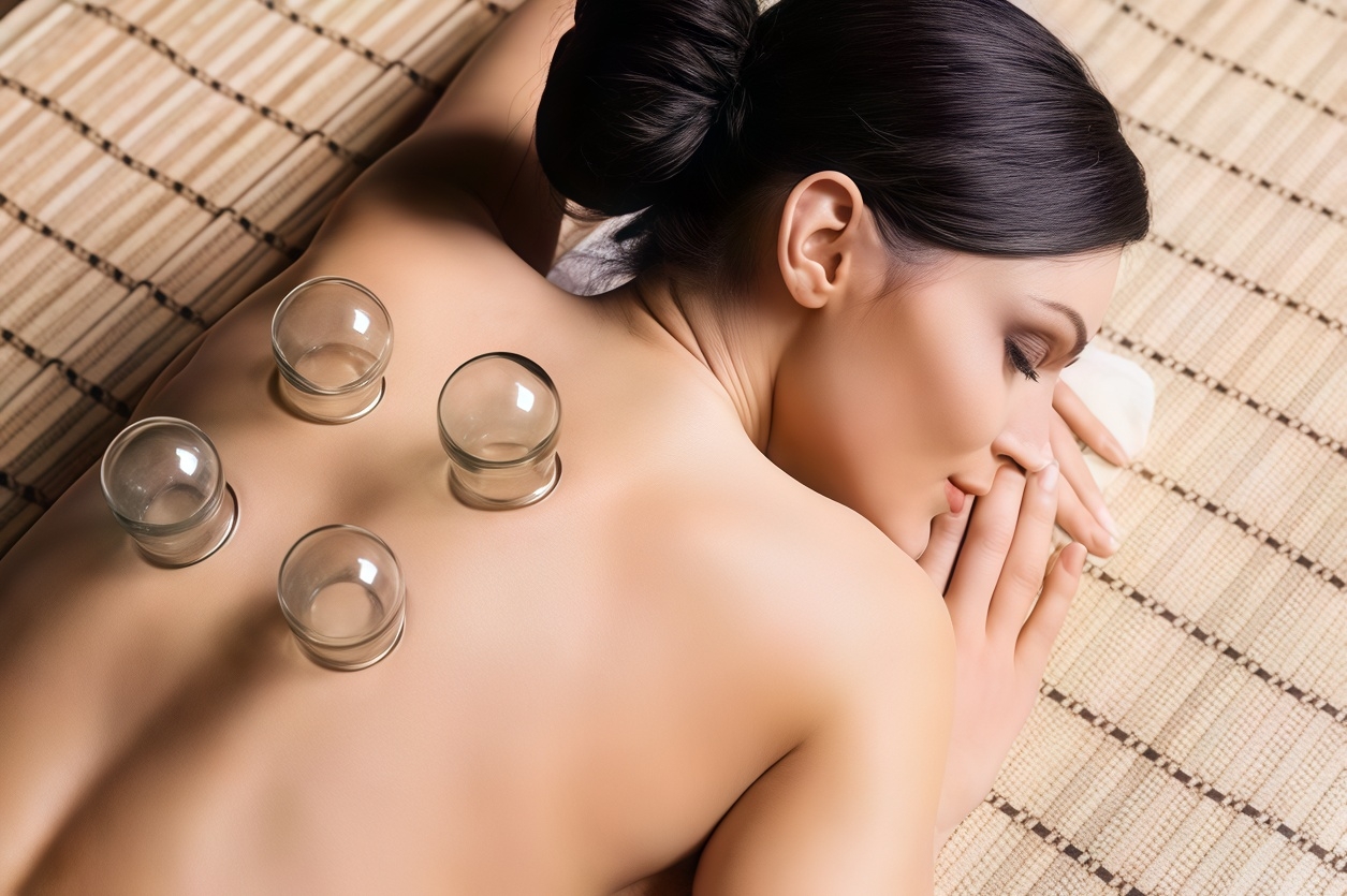 Cupping